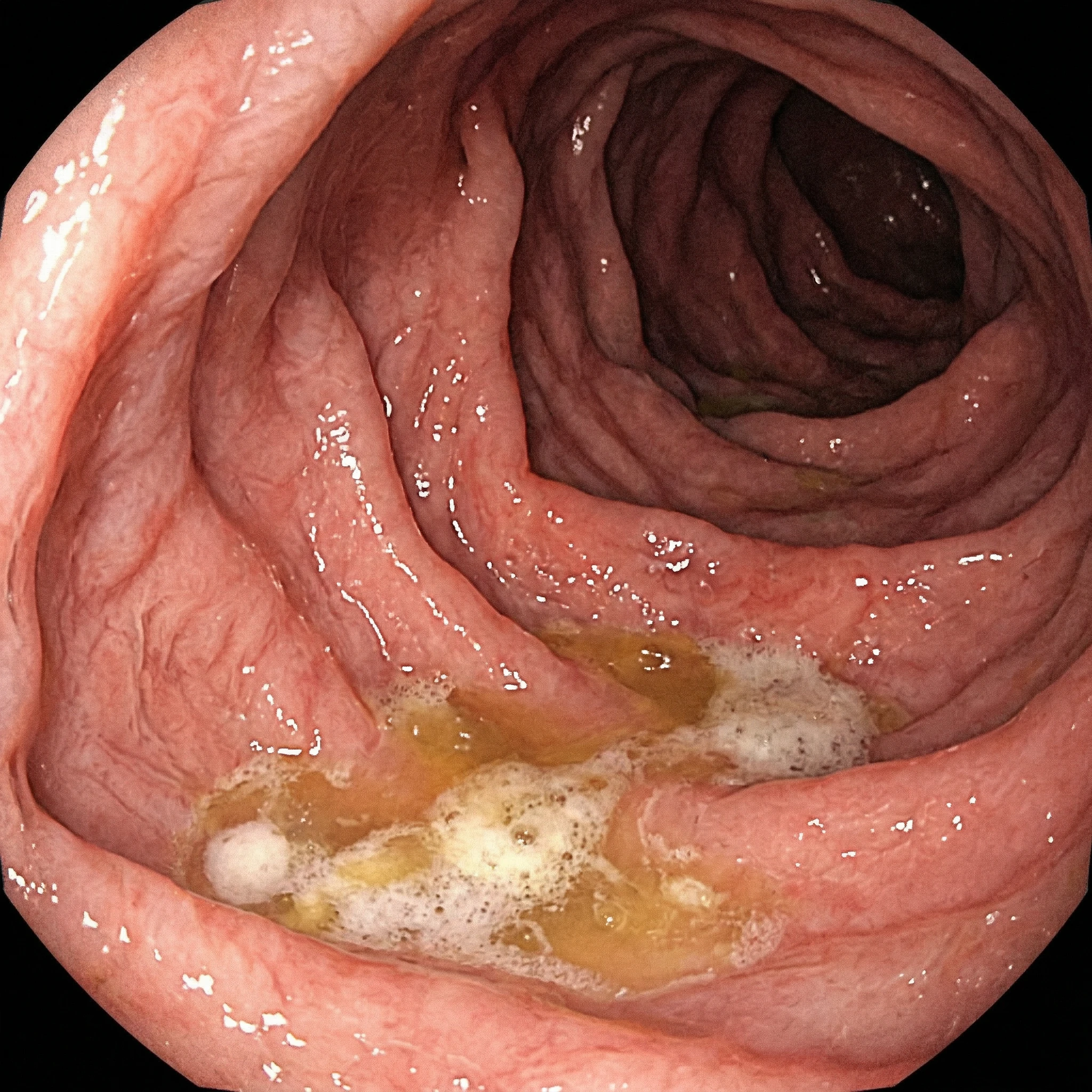Endoscopic View of Dog's Empty Stomach Interior