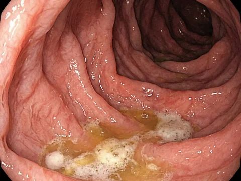 Endoscopic View of Canine Stomach Interior